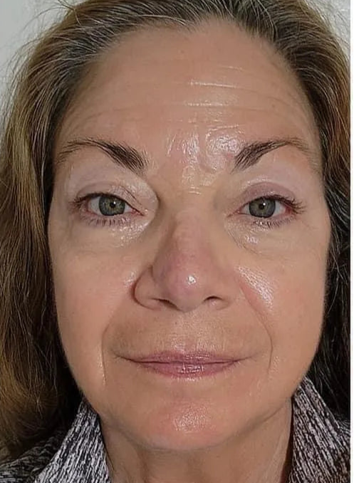 Before_After_ageLOC_truface_Peptide_retinol_01A