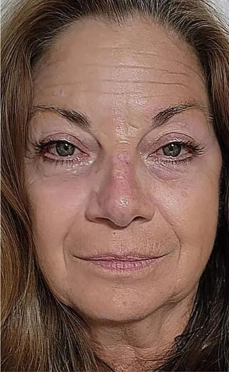 Before_ageLOC_truface_Peptide_retinol_01