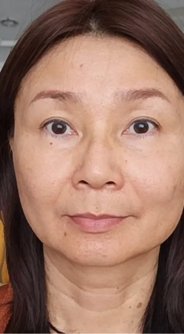 Before_After_ageLOC_truface_Peptide_retinol_02A