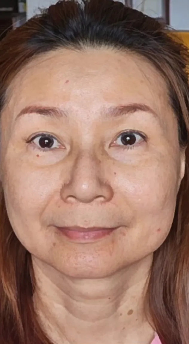 Before_After_ageLOC_truface_Peptide_retinol_02B