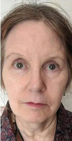 Face_Yoga_Testimonial_Mary_Fox_Couzens_01A