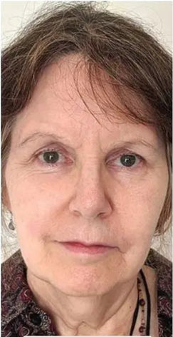 Face_Yoga_Testimonial_Mary Fox Couzens_01B