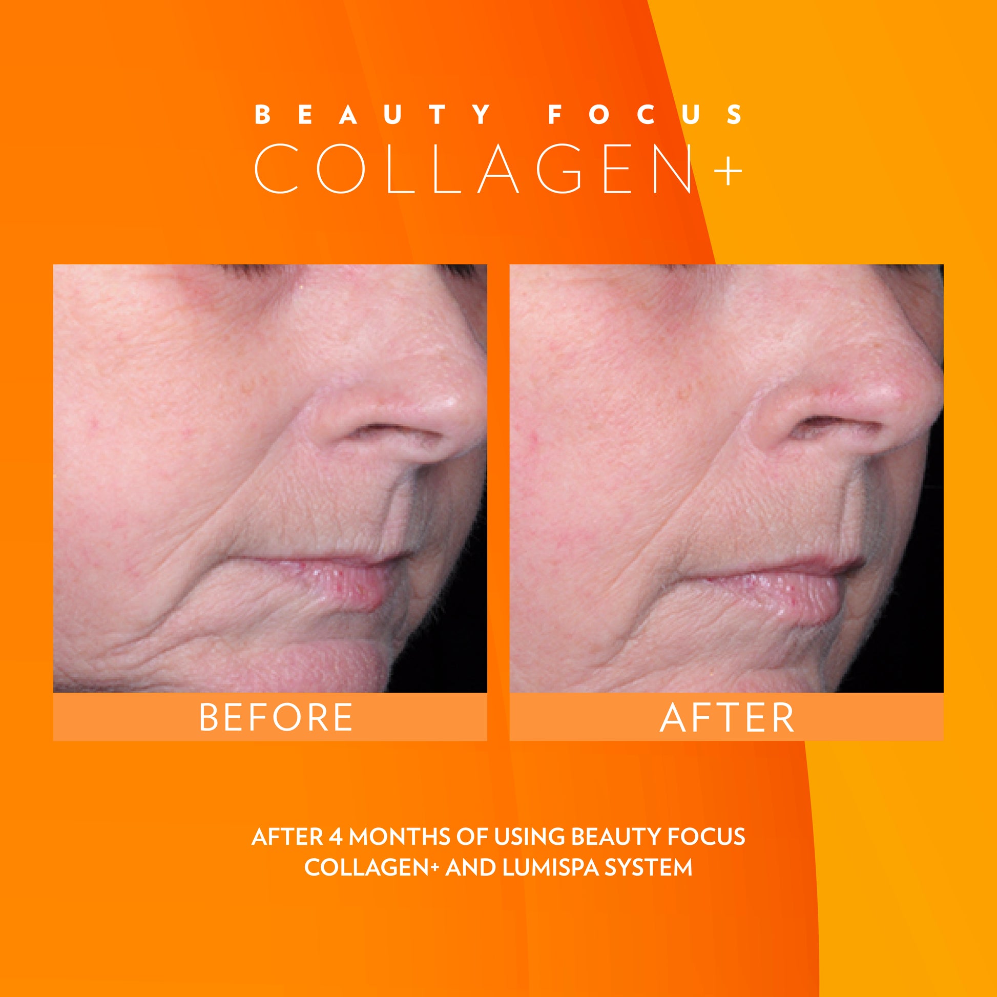 Before and after comparison of skin using Beauty Focus Collagen+ and Lumispa system on an orange background.